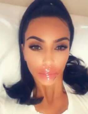 Kim Kardashian – ajak maszkban